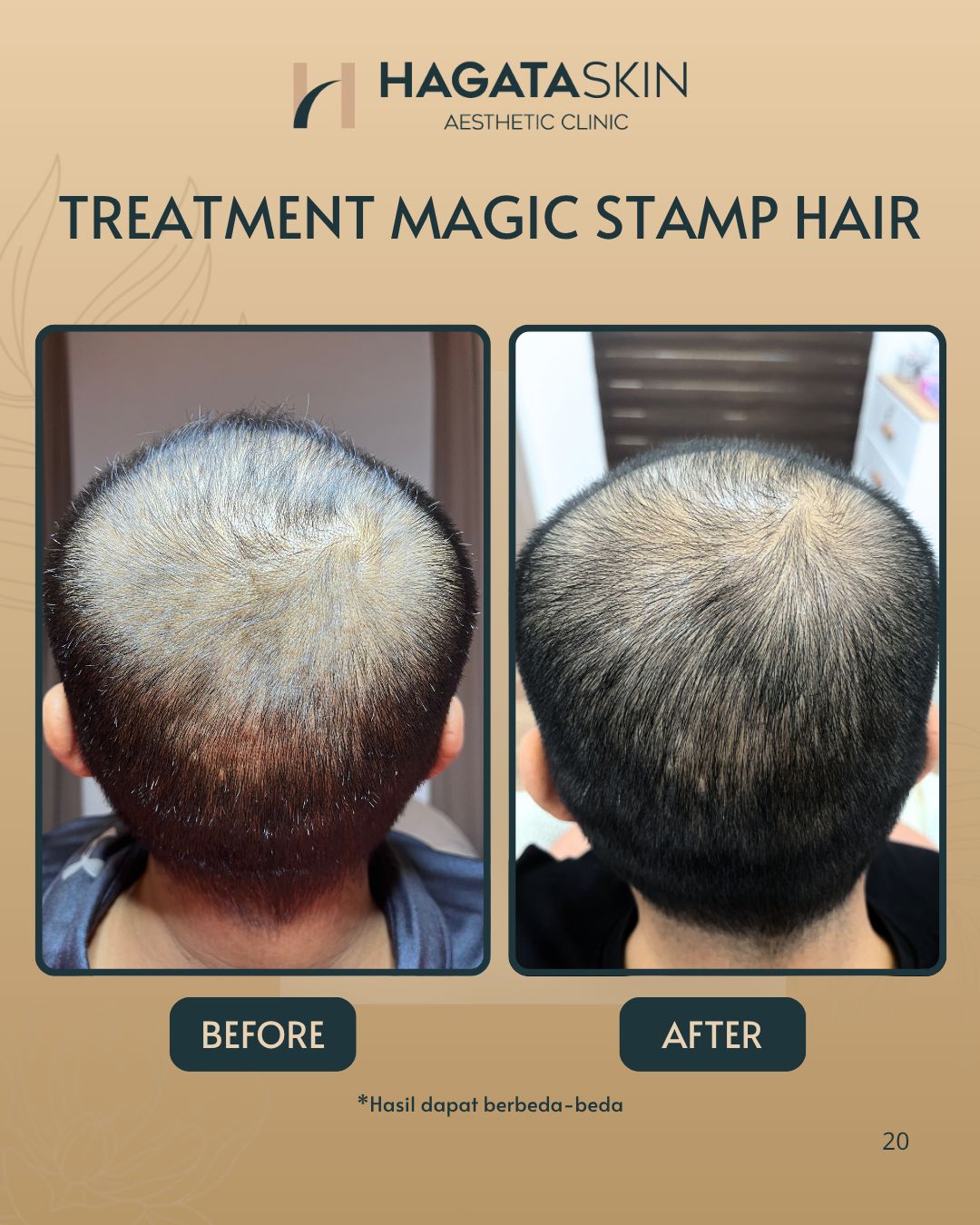 BEF0RE AFTER MAGIC STAMP (2)