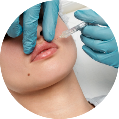 Treatment - Filler (Circular) Treatment - Filler